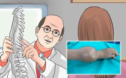 Cẩn thận với những triệu chứng cảnh báo bệnh ung thư xương đang ở giai đoạn cuối