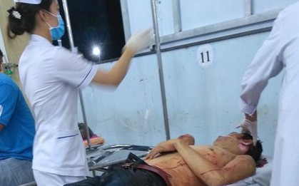 Cản ca hát trong đám giỗ, người đàn ông bị chém trọng thương