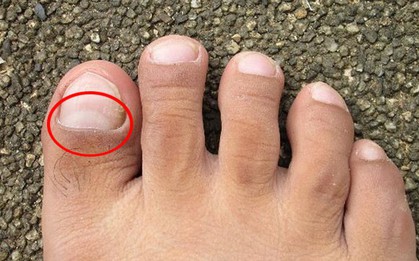 Thận đang dần suy yếu nếu chân của bạn gặp phải những vấn đề sau