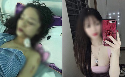 Chị ruột cô gái bị tấn công phải khâu 60 mũi: "Mặt em tôi bị rạch như thế thì coi như hết đời người rồi"