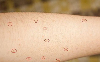 Nguy cơ mắc bệnh ung thư đang nhen nhóm trong cơ thể bạn nếu xuất hiện các triệu chứng sau