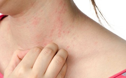 Đây là những dấu hiệu nhắc bạn nên tìm cách thải độc cho cơ thể ngay, nếu để lâu sẽ rất tai hại