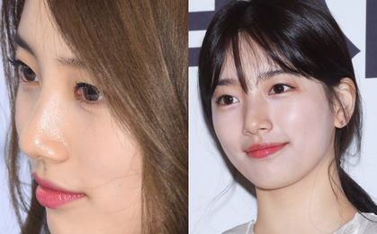 Sốc khi nhìn hình ảnh zoom vào từng lỗ chân lông của Suzy: Làn da của nữ hoàng mặt mộc liệu có tuyệt vời đến thế?