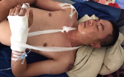 Đi đòi nợ, nam thanh niên ở Đắk Lắk bị đánh nhập viện