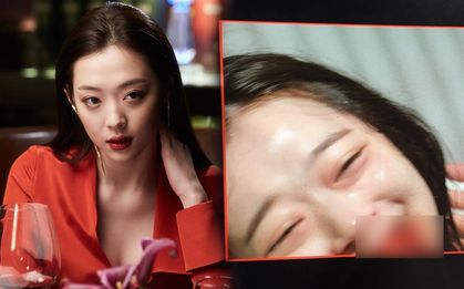 Đăng ảnh vừa cười vừa hộc máu mồm lên Instagram, chuyện gì đang xảy ra với Sulli vậy?