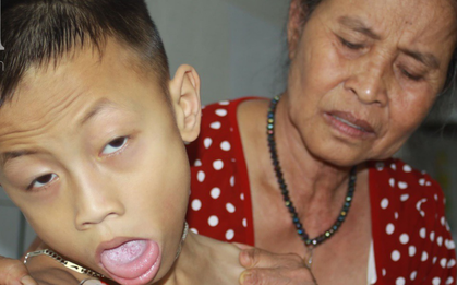 Xót cảnh bố mẹ bị khuyết tật, bé trai 10 tuổi bại não sống cạnh bà nội già yếu, cơm ngày ba bữa không đủ no