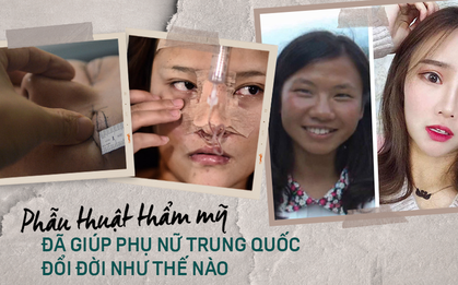 Những cô gái "đập mặt xây lại" ở Trung Quốc: Đời sang trang nhờ diện mạo mới đến nỗi xem bác sĩ thẩm mỹ là cha mẹ thứ 2