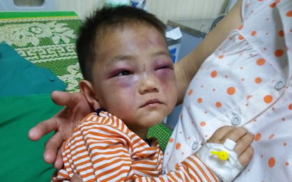 Hơn một năm, cuộc sống của bé trai 4 tuổi mồ côi, bị cha dượng đánh đập dã man khi đến thăm mẹ giờ ra sao?