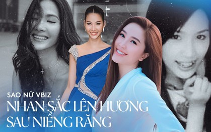 Chưa cần đến dao kéo, chỉ niềng răng thôi mà nhan sắc dàn mỹ nhân Viz đã thăng hạng lên bội phần