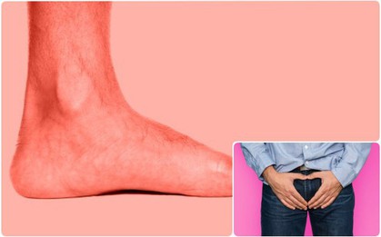 Có phải chân càng to thì "cậu nhỏ" cũng to? Đây là lời giải cho thắc mắc kinh điển của cánh đàn ông trên thế giới