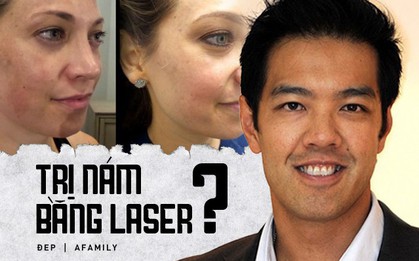 Tưởng trị nám bằng laser rất thần kỳ nhưng nhiều bác sĩ da liễu lại không khuyến khích áp dụng