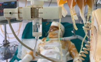 Vụ chém, đổ 30 lít xăng đốt nhà người tình: Ám ảnh tiếng kêu cứu lúc sáng sớm