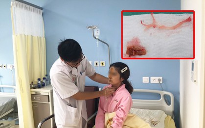 Cô gái Hải Phòng suýt nứt thực quản vì hóc thịt bò trong cổ họng suốt 3 ngày