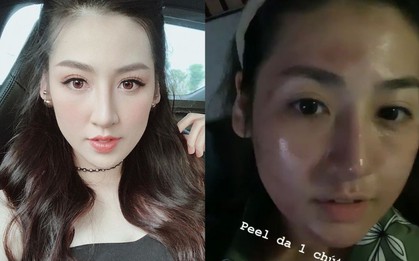 Phải chăng nhờ phương pháp nghe tên đã thấy hơi “rén” này, Á hậu Tú Anh mới sở hữu làn da mộc đẹp căng đến vậy?