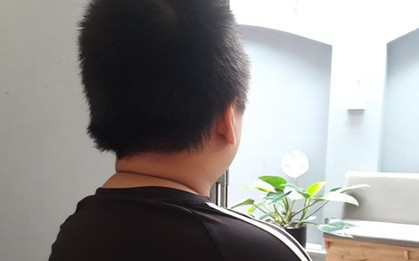 Nghi án bố cùng dì ghẻ bạo hành con trai dã man suốt nhiều năm ở Phú Thọ: Đốt túi bóng nhỏ vào mông, bắt nhặt cơm dưới đất lên ăn