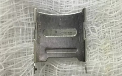 Bé 2 tuổi ở Hà Nội phải vào viện cấp cứu vì nuốt khay sim điện thoại