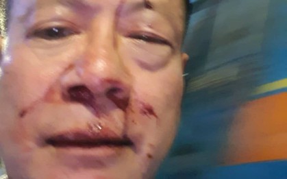 Khởi tố vụ nhóm thanh niên đánh Việt Kiều Đức trọng thương trong quán karaoke ở Sài Gòn