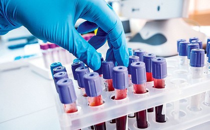 Phát hiện cholesterol "xấu xí" vô cùng đáng sợ