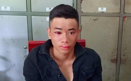 Thanh niên nghiện ma túy dùng kim tiêm đâm chiến sĩ công an khi bị vây bắt