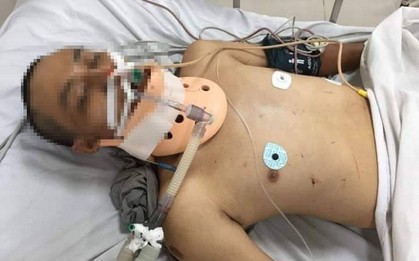 Tìm thân nhân một người trong nhóm đi bộ xuyên Việt bị tai nạn tử vong