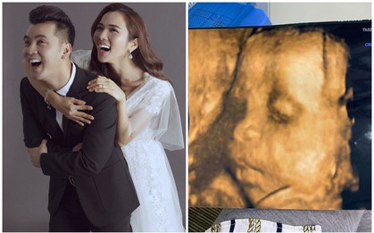 Bà xã Ưng Hoàng Phúc đăng ảnh siêu âm con thứ 3, hạnh phúc khoe mặt giống hệt anh ba Jonny