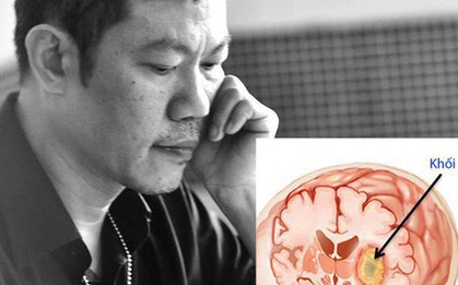 Người hâm mộ sốc nặng khi nhạc sĩ Quốc Bảo bị u não - Căn bệnh nguy hiểm nhưng các dấu hiệu thường bị bỏ qua