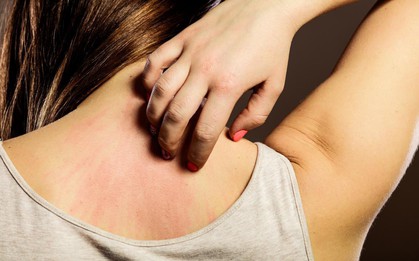 Tưởng trời nắng đẹp đang độ vào thu nhưng vẫn có hàng tá thứ bệnh rình rập sức khỏe của bạn