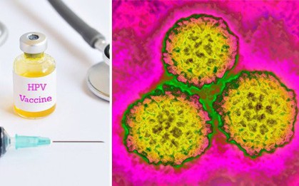 Bác sĩ cảnh báo: Đây là loại virus lây nhiễm qua đường tình dục có thể gây ung thư miệng, hậu môn, dương vật và cổ tử cung