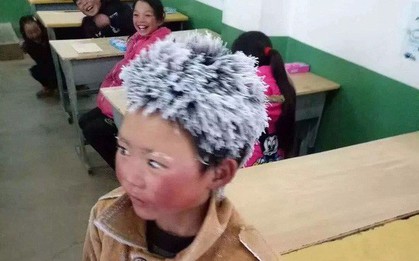 Sau 1 năm khiến cả thế giới xúc động, cuộc sống của cậu bé "tóc đóng băng" đáng thương giờ ra sao?