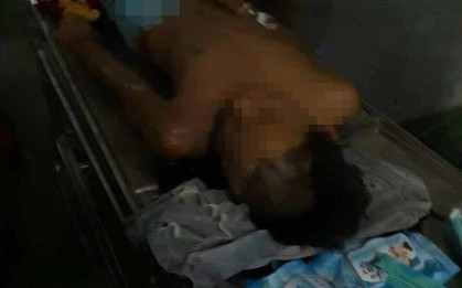 Thanh Hóa: Bị sét đánh, nam thanh niên thoát chết hy hữu