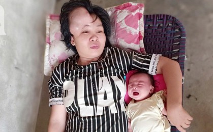 Người mẹ mang khối u khổng lồ, giành giật sự sống từng ngày để sinh con: “Em muốn nhìn con lớn một chút nữa rồi chết"