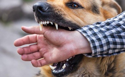 Thanh niên tử vong sau 3 tháng bị chó nhà cắn