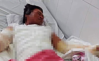 Lời nói dối nghẹn ngào của người mẹ chăm bố bị điện giật nặng: "Ba con khỏe lắm, con phải ở nhà ngoan với ngoại"