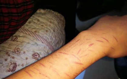 Mẹ là giáo viên giỏi nhưng không ngăn được con gái quan hệ tình dục với nam sinh cùng trường và tự tử ở tuổi 15