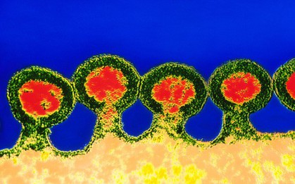 Một bệnh nhân ung thư nhiễm HIV ở Trung Quốc được điều trị bằng tế bào gốc chỉnh sửa gen