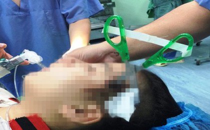 Nghệ An: Bị kéo nhọn găm vào đầu 3cm, bé gái 10 tuổi nhập viện nguy kịch