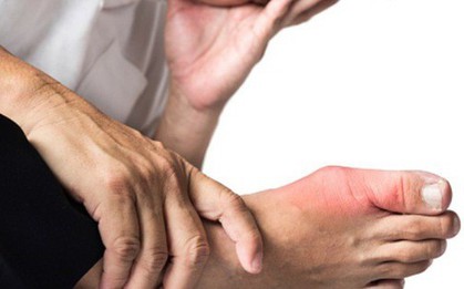 Nguyên nhân bất ngờ khiến nhiều người dễ bị bệnh gút