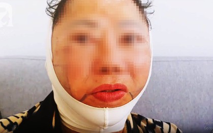 Trong các phương pháp căng da mặt, căng da mặt bằng chỉ, dù nhẹ nhàng nhất nhưng cũng có rủi ro biến chứng đi kèm!