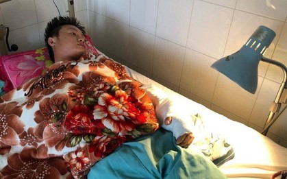 Ghép nối thành công bàn tay thanh niên bị chém đứt lìa sau cuộc nhậu