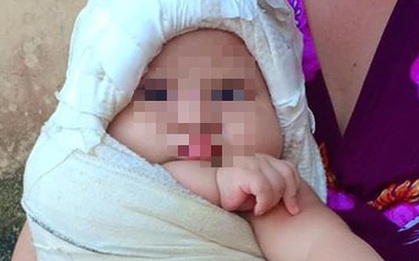 Người nhà "tố" bác sĩ làm đứt dây chằng cánh tay bé gái mới sinh