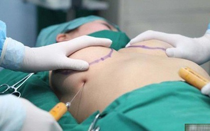 Cô gái trẻ ở TP HCM bị vỡ 2 túi độn ngực cùng lúc