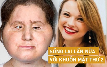 Hành trình của người phụ nữ trẻ nhất thế giới được cấy ghép khuôn mặt từ người hiến tặng và cuộc chiến với tử thần kéo dài 31 tiếng