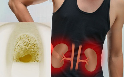 Nguy cơ suy thận rất cao nếu cơ thể của bạn xuất hiện từ 1 đến 4 triệu chứng khác lạ