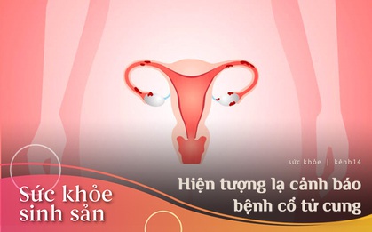 Nếu vùng dưới có trên 2 trong 4 hiện tượng bất thường, bạn nên chủ động đi khám vì nguy cơ mắc bệnh cổ tử cung rất cao