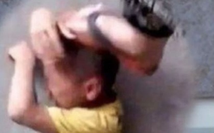 Bé gái 9 tuổi bị bạn học hành hung, mẹ và bà tức giận "trả đũa" đứa trẻ kia một cách dã man, thái độ của nhà trường gây ức chế