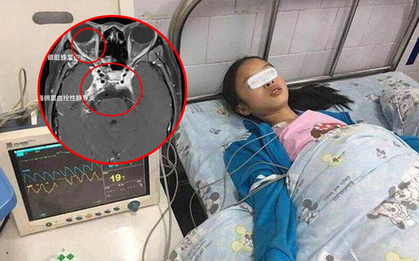 Ngoáy tai, ngoáy mũi, nặn mụn có thể gây tử vong: 5 hành động "ngứa tay" quen thuộc rất nguy hiểm, không nên làm tùy tiện