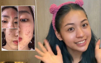 Thanh Tâm "trứng rán" đã lấy hết can đảm công khai mặt mộc nhưng vẫn bị antifan tố nói dối