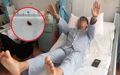 Chàng trai mới 27 tuổi đã bị nhồi máu não, nguyên nhân xuất phát từ thói quen mà phần lớn người trẻ đều mắc phải