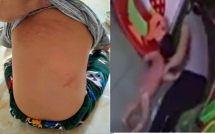 Vụ việc gây bức xúc: Cháu bé mầm non bị cô giáo bạo hành trong nhà vệ sinh, 1 cô khác thờ ơ đứng xem, dửng dưng như không có gì