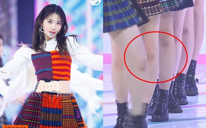 IZ*ONE lộ đầu gối bầm dập đầy thương tích trong sân khấu comeback, fan xót xa vì vũ đạo quá “khoai” mà lại không có đồ bảo hộ